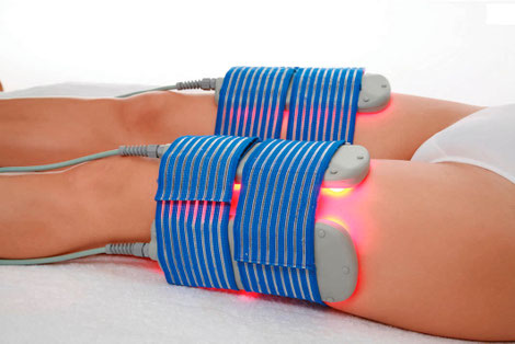 Laser lipolitico centro de estética Molina de Segura