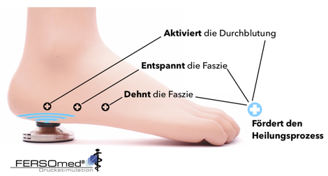 Fersensporn Behandlung mit FERSOmed® Druckstimulation