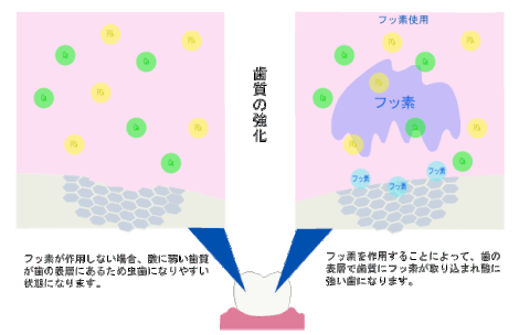 資質の強化