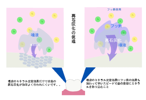 再石灰化の促進