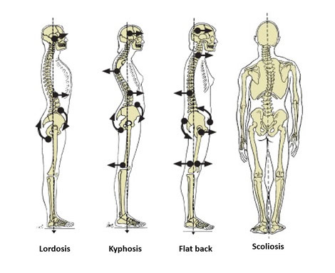 Types of postures that can lead to back pain.