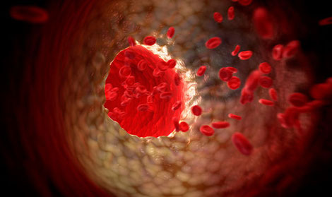 Cholesterol particles in the blood stream