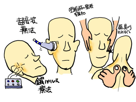 顎関節症 あごの痛み 顎内障 国分寺 こみね鍼灸整骨院