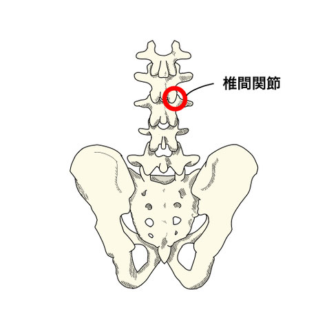 ぎっくり腰 椎間関節  反ると痛い