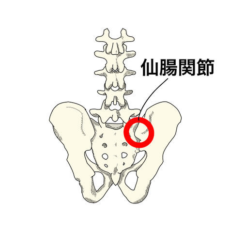 ぎっくり腰 仙腸関節 国分寺市 こみね鍼灸整骨院 ベットから起き上がり辛い
