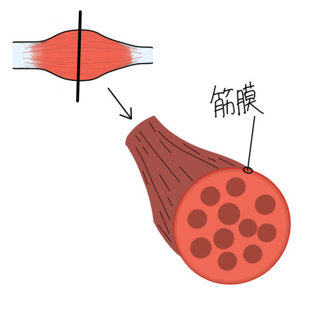 ぎっくり腰の原因の一つ 筋筋膜性腰痛のイラスト