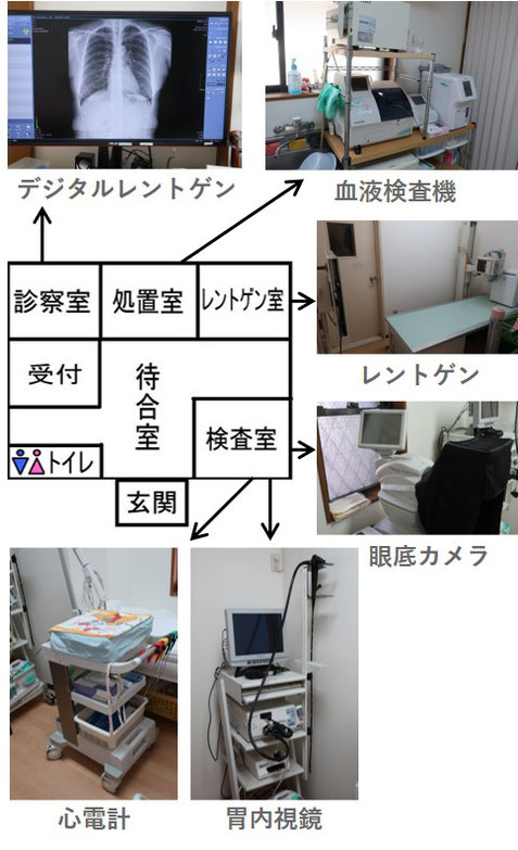 当院の医療機器　眼底カメラ、血液検査機、レントゲン、胃内視鏡、心電計