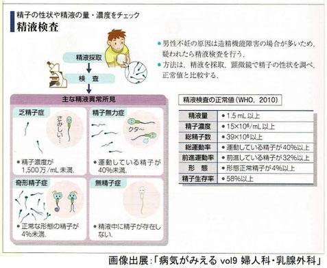 精子の性状や精液の量・濃度をチェック