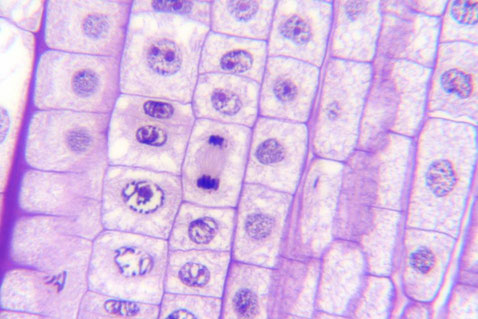 Mitosis en células de la raíz de una cebolla.