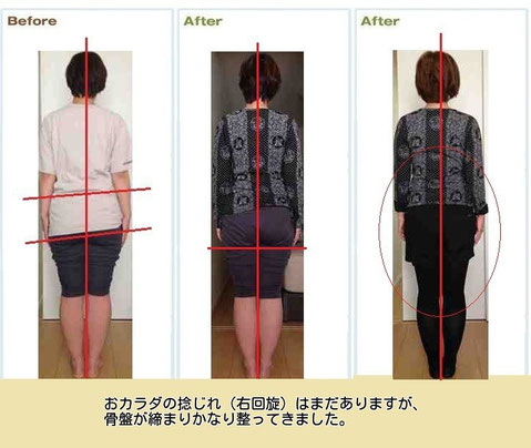 ※お客様個人の感想です。矯正後の感じ方は個人差がございます。