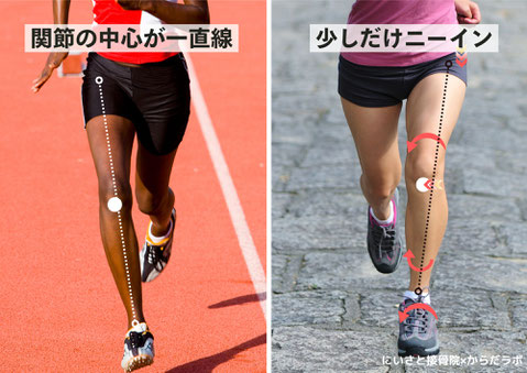 ニーインとは、ヒザが「内乱」すること