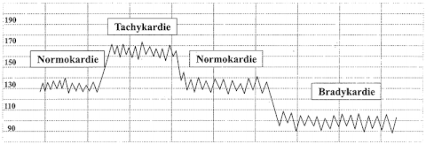 Kardiotokografie (CTG) - schwangerschaftsfahrplan.de