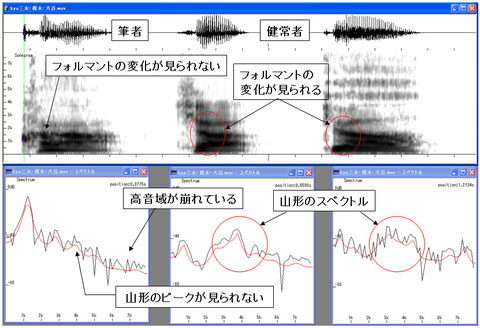 図9 筆者と健常者の「キャ」の違い