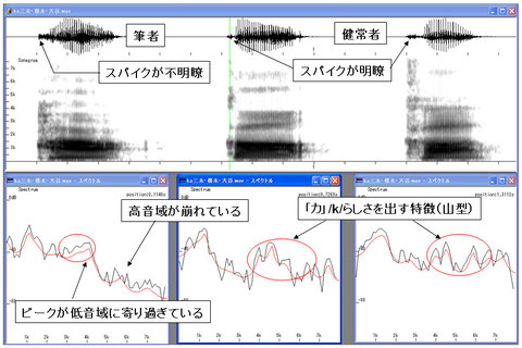 図8 筆者と健常者の「カ」の違い