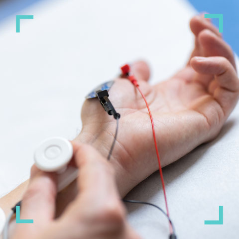 Messung der Nervenleitung am Unterarm während einer Elektroneuromyographie (ENMG) in der neurologischen Praxis Neuro im Zentrum St. Gallen
