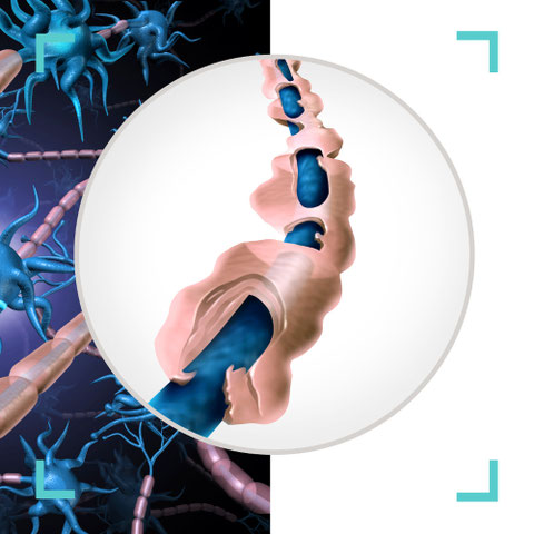 arstellung von Rückenmark und Nervenzellen – Diagnostik und Behandlung von Multipler Sklerose in der Praxis Neuro im Zentrum St. Gallen