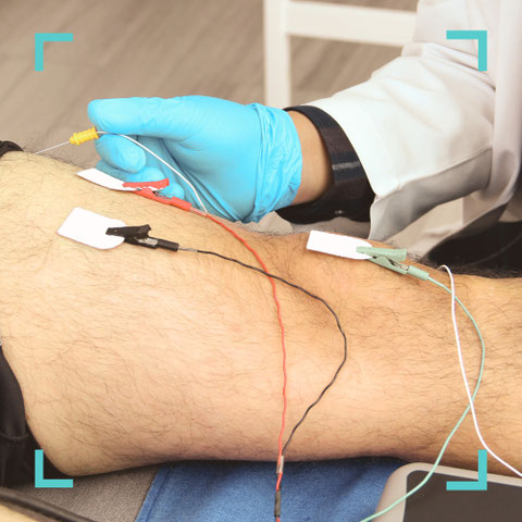 Ableitung evozierter Potenziale mit Elektroden am Bein während neurologischer Untersuchung in der Praxis Neuro im Zentrum St. Gallen