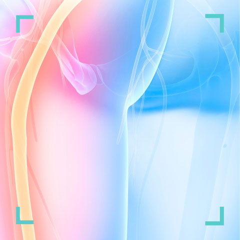 Grafische Darstellung eines Nervs im Hüftbereich – Behandlung von Engpasssyndromen in der Praxis Neuro im Zentrum St. Gallen