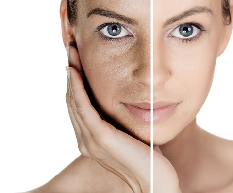 Tratamiento faciales Dermaarte