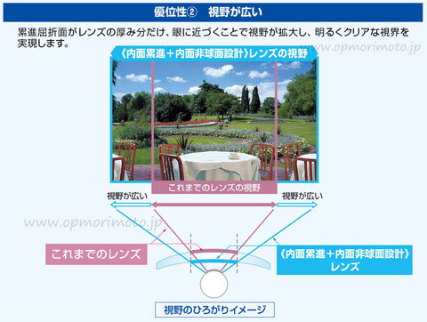 網膜像評価設計、内面累進+内面非球面設計　イメージ