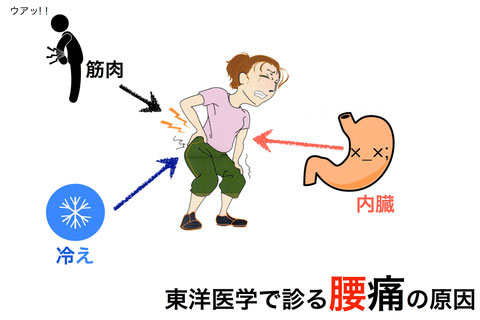 鍼治療でみる腰痛の原因。港区の鍼灸院