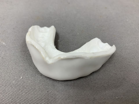 向ケ丘遊園駅北口徒歩3分、登戸駅徒歩10分、多摩区役所そばのカワシマ歯科医院 スポーツ用マウスピース