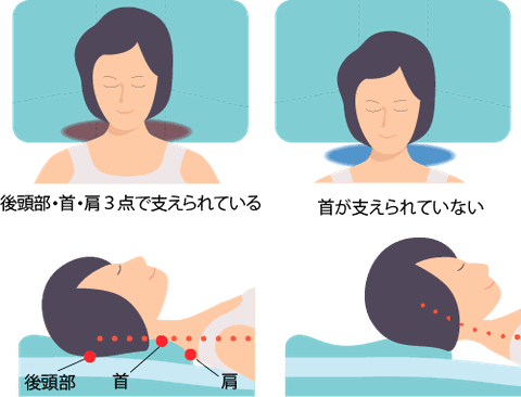 まくらのあて方　後頭部・首・肩の3点で支えられていると安定します。端にあたまをのせると支えられていません