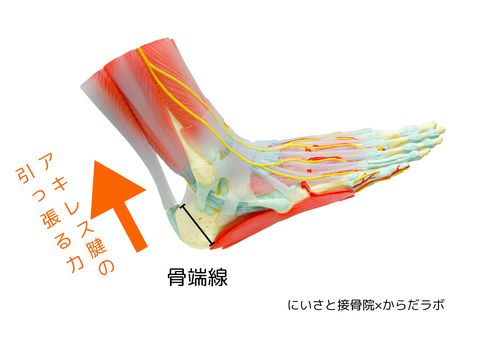 かかとの骨（踵骨）の骨端線とアキレス腱