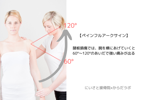 腱板損傷時、腕を横にあげると60°～120°で痛みが生じることを「ペインフルアークサイン」という