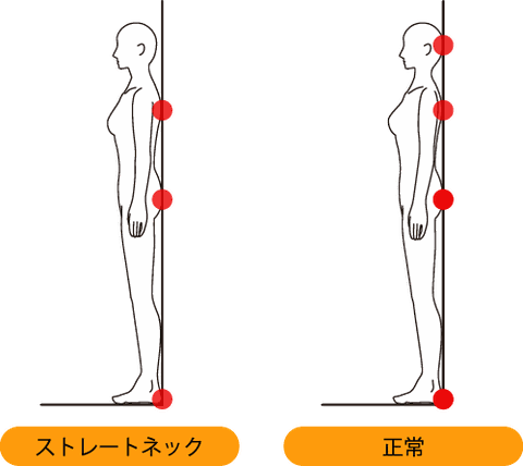 簡単なストレートネックの調べ方