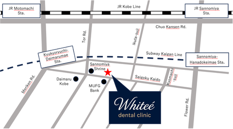 Map of Whiteé dental clinic (English-speaking dentist)