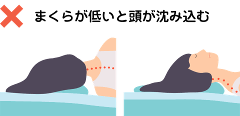 枕が低いと頭が沈み込むと首が曲がり良くないという説明図