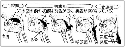 図11 誤嚥過程