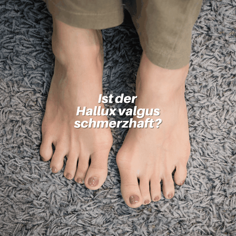 Physio bei Hallux Fuß