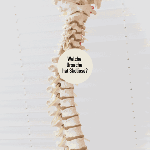 Ursachen von Skoliose