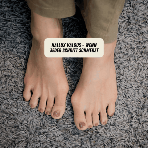 Physiotherapie Hallux Valgus
