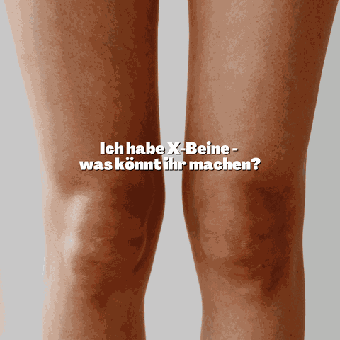 Operation bei O Beine?