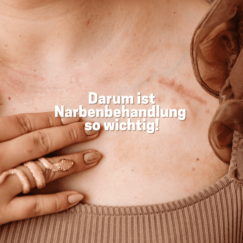 Narbentherapie Basel, Narben Physiotherapie Basel