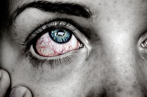 ein rotes Trockenes Auge