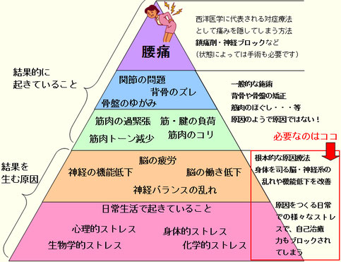 腰痛の根本的な原因