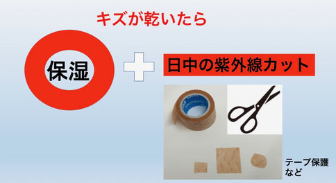 創部が乾いたら、保湿と紫外線予防が大切です。