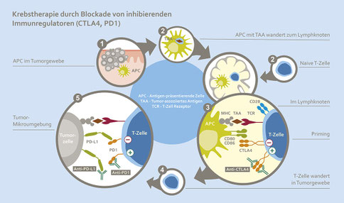 Schematische Darstellung der Krebsimmuntherapie durch Blockade von CTLA4 und PD1: Ablauf von der Antigenpräsentation bis zur Aktivierung und Migration der T-Zellen ins Tumorgewebe.