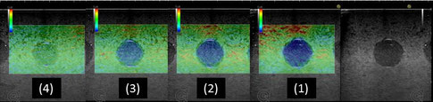ELPT-003C　エラストグラフィ像とBモード像