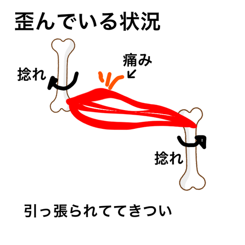 これが歪んだ筋肉、肩こりの原因です。相模原市南区古淵の塚原バランス整体院へぜひお越しください