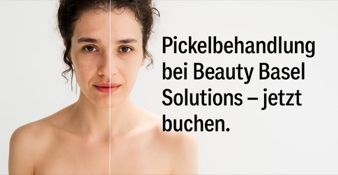 Pickel Behandlung Basel Stadt