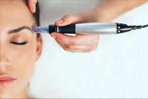 Micronneedling Pen