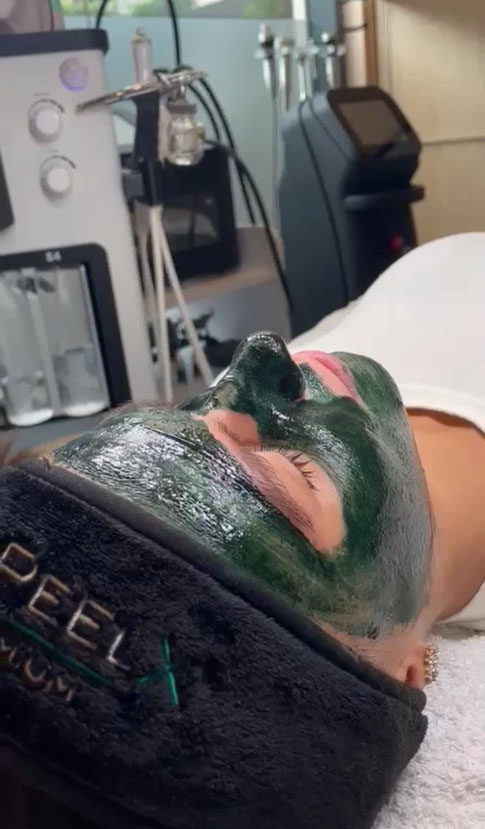 Green peeling X