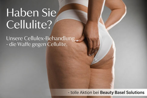 Cellulex Cellulites basel Kosmetik