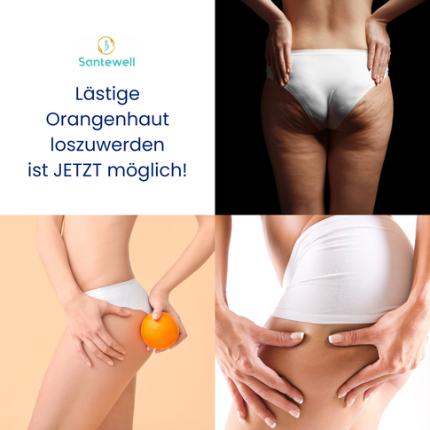 Anti-Cellulites Aktion Basel, Cellulite - Orangenhaut behandeln lassen