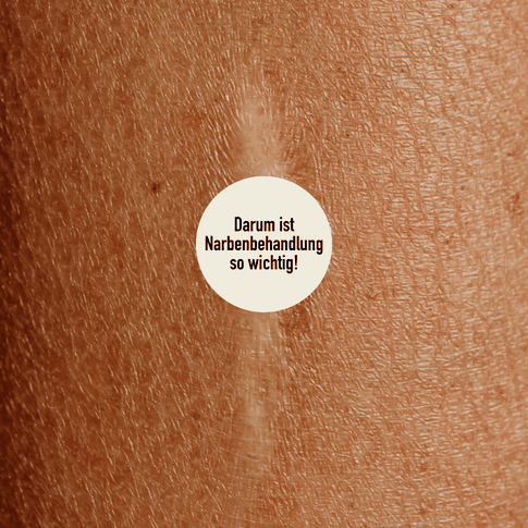 narben behandlung basel